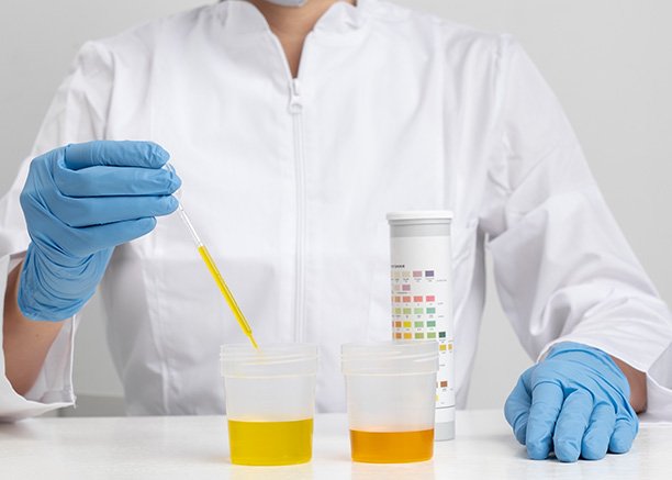 UTI Treatment Procedure